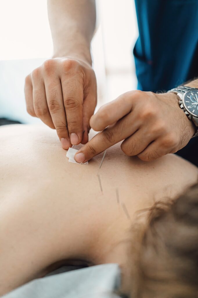 Woman stabbed in the back with needle in bright acupuncture clinic